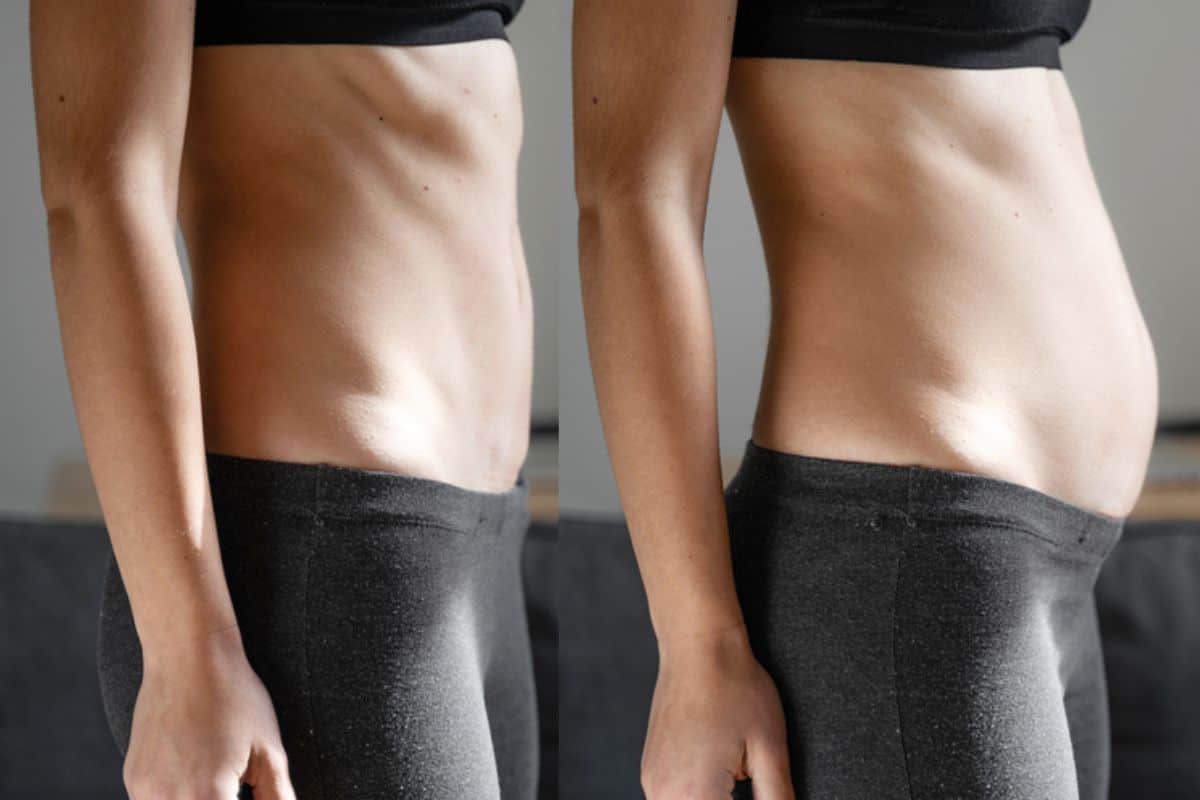 How long does diastasis recti take to improve Bagshot?