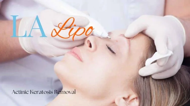 Woman receiving Actinic Keratosis Removal Treatment Bagshot