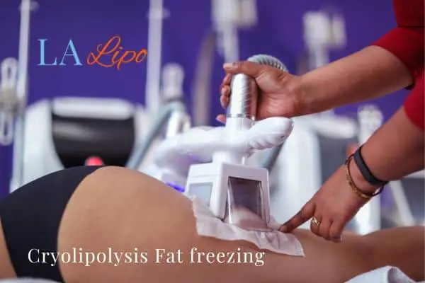 women getting fat freezing Bagshot
