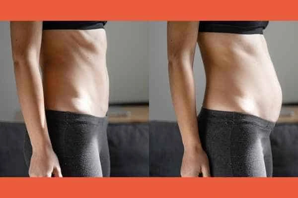 LA-EMS Body Sculpting results Bagshot