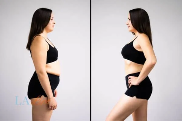 link between body image and mental health Bagshot