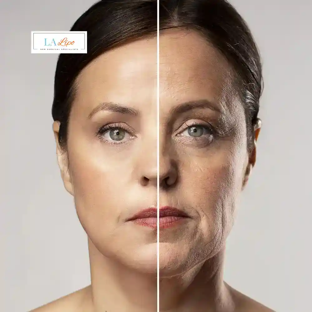 How Can You Tell If Non-Surgical Skin Tightening Is Right for You Bagshot?