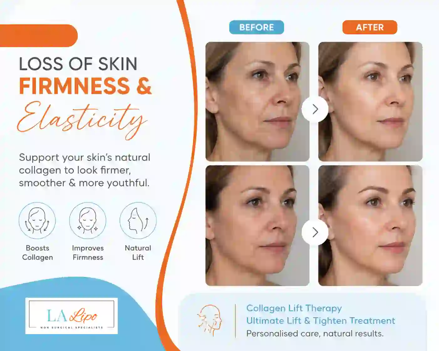 Sign #7: Loss of Skin Firmness and Elasticity Bagshot