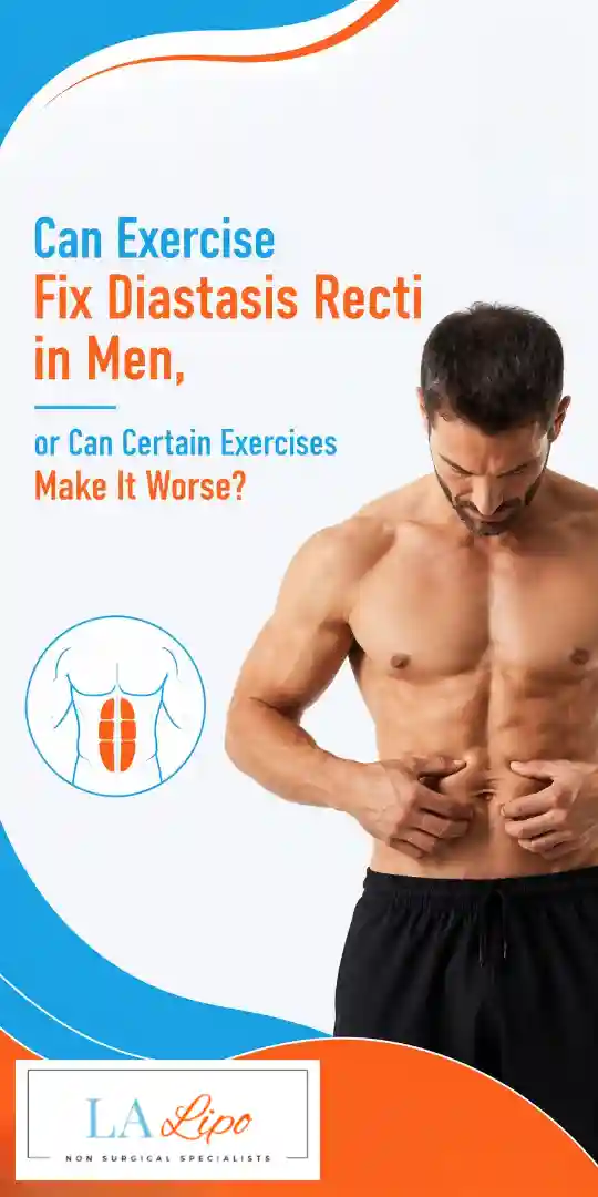 Can Exercise Fix Diastasis Recti in Men, or Can Certain Exercises Make It Worse Bagshot?