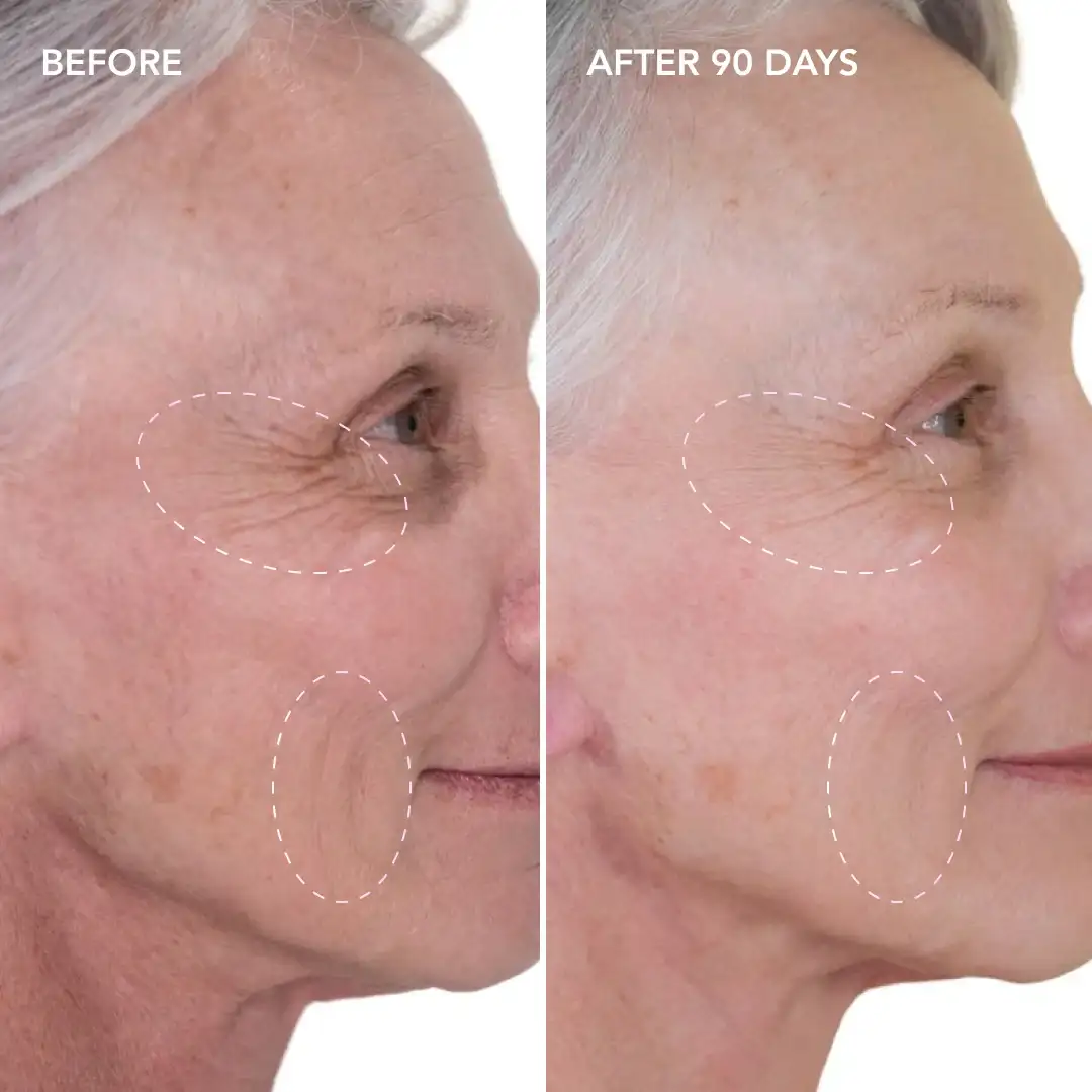When will you see results Bagshot